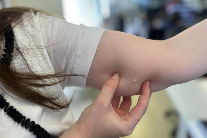 Implante Contraceptivo no SUS do Paraná: Crescimento Surpreendente de 118% em 2025 Implante Contraceptivo no SUS do Paraná: Crescimento Surpreendente de 118% em 2025